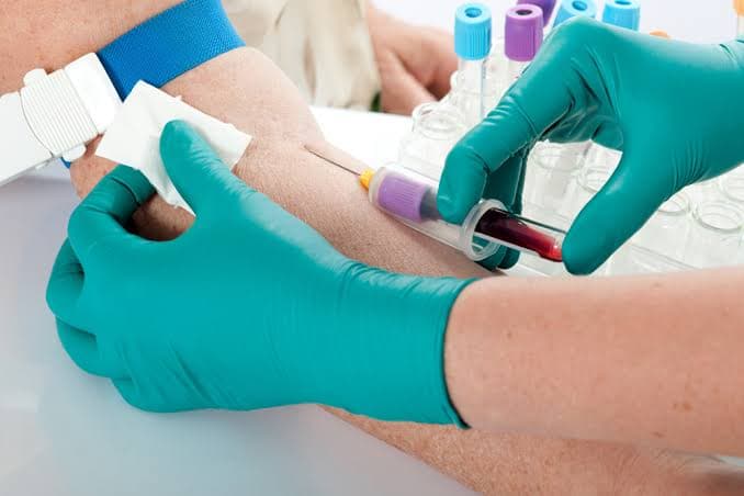 Exame de sangue que consegue detectar Alzheimer chega ao Brasil