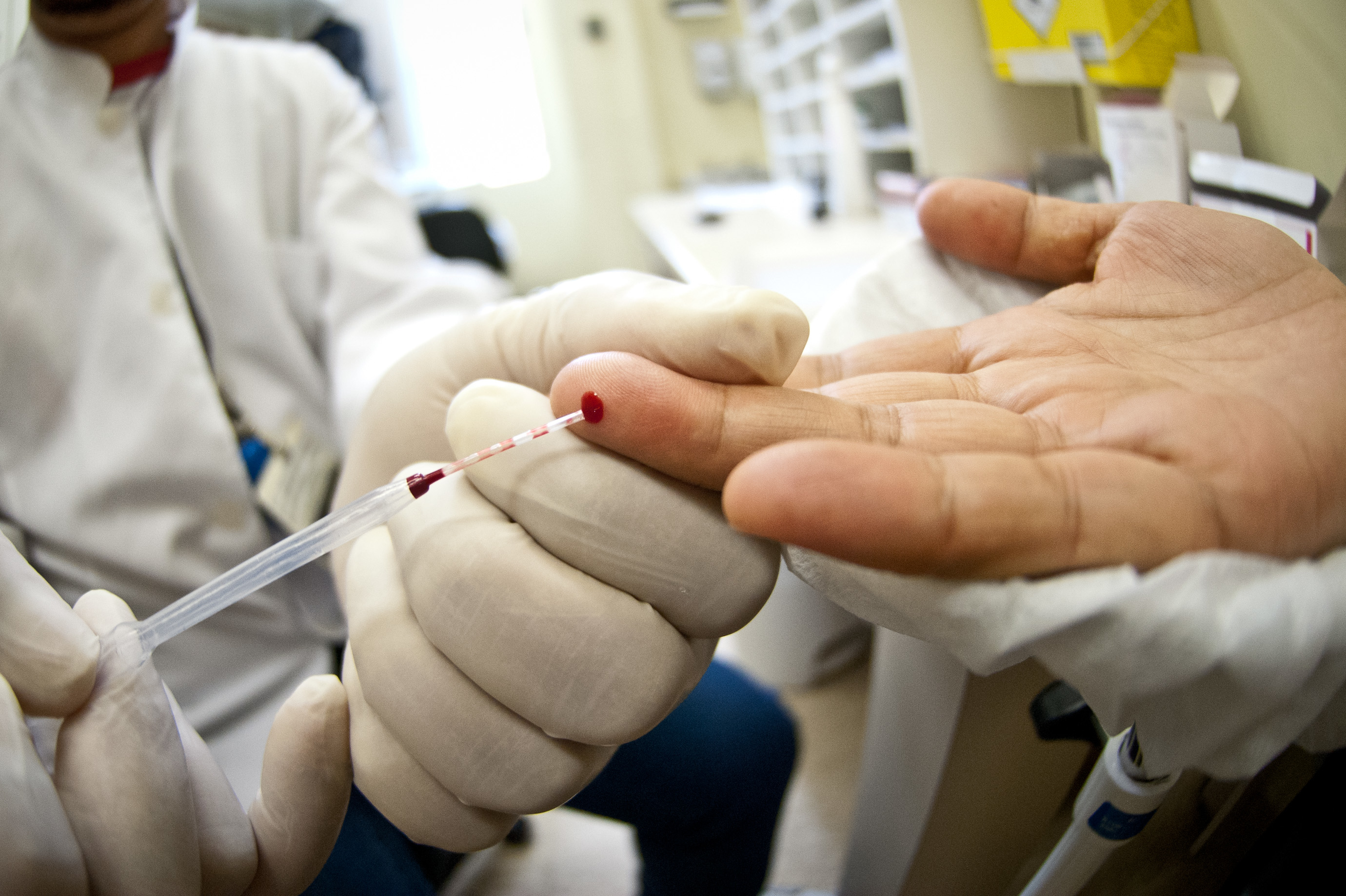 Ministério da Saúde compra 4 milhões de testes que detectam HIV e sífilis