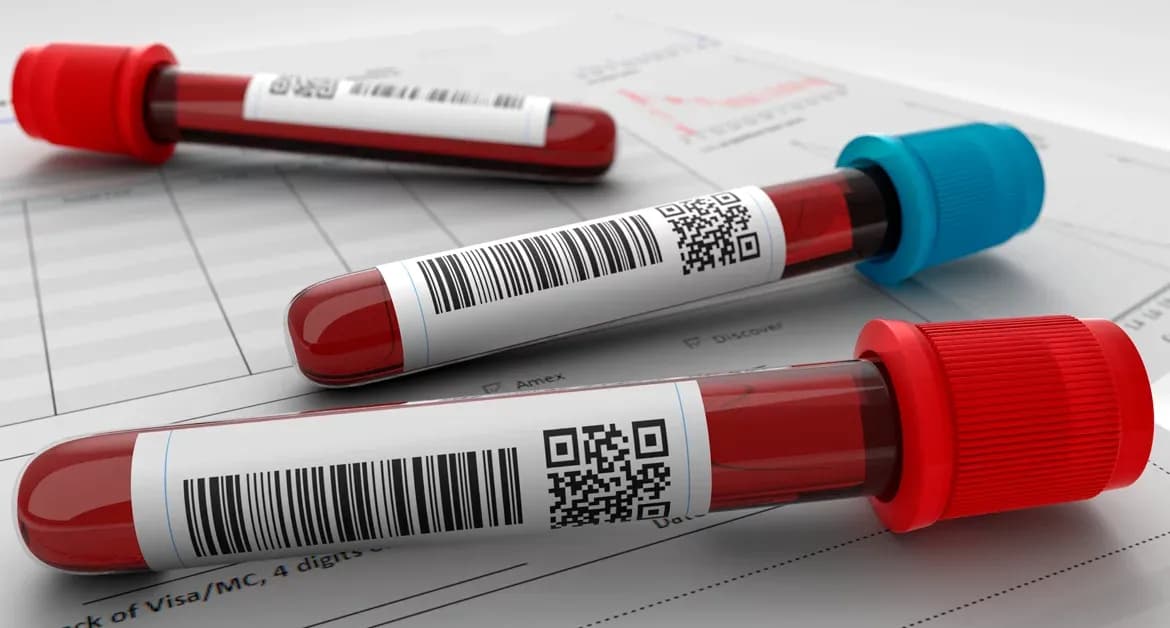 Exame de sangue será capaz de diagnosticar transtorno de bipolaridade